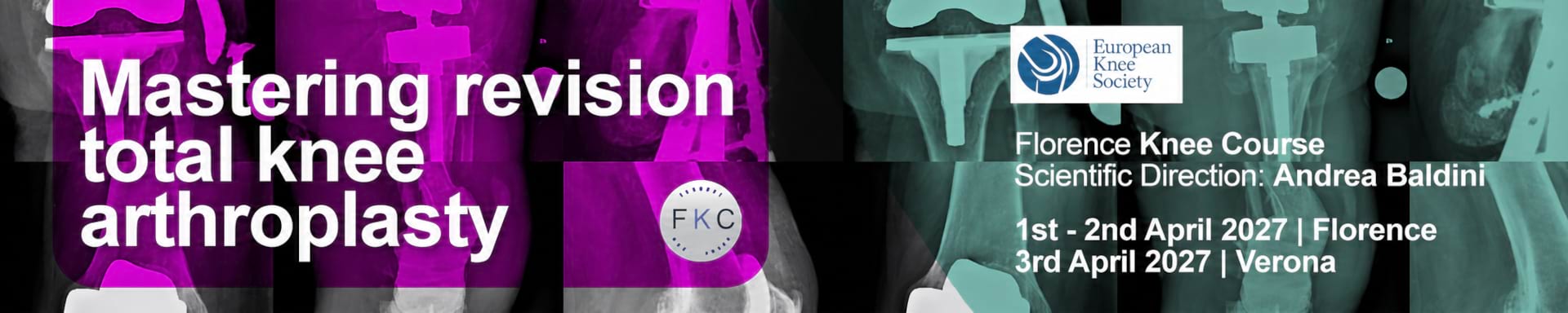 Mastering Revision Knee Arthroplasty